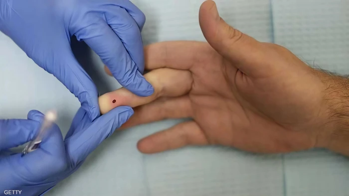 «شفاء رجل في النرويج من فيروس الإيدز بطرق مبتكرة»