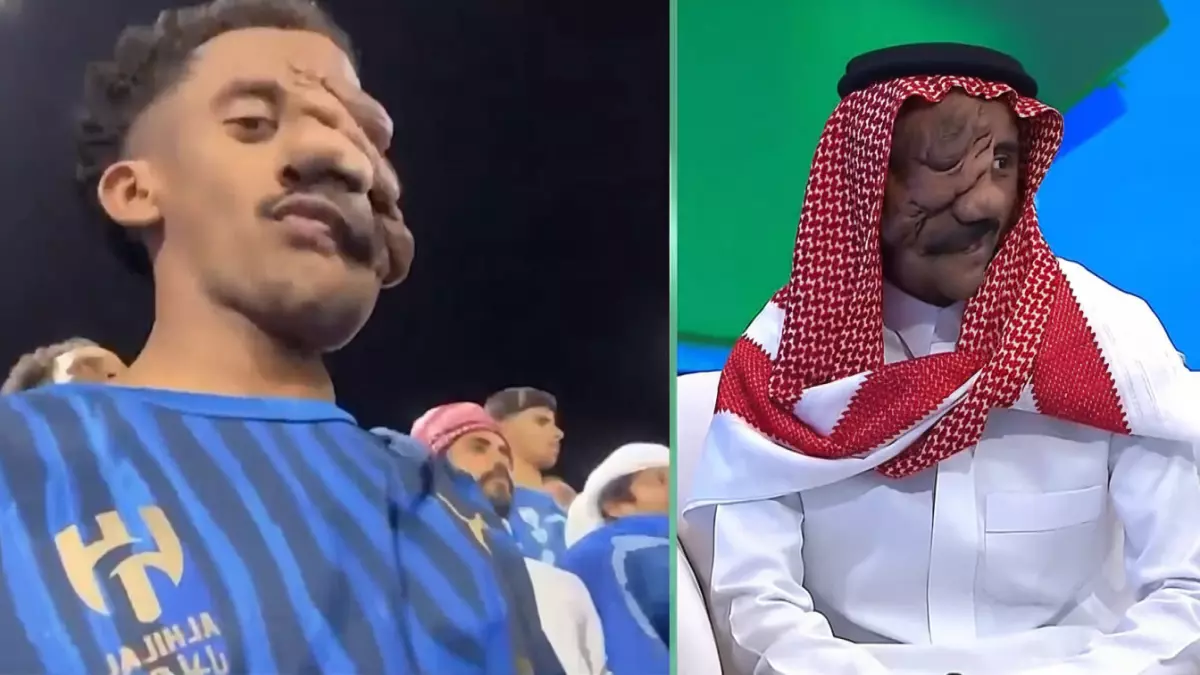 «شجاعة وإصرار» شاب من الأحساء يلهب مشاعر الملايين بإبداعه في تحويل إعاقته إلى نجاح مذهل مع جماهير الهلال