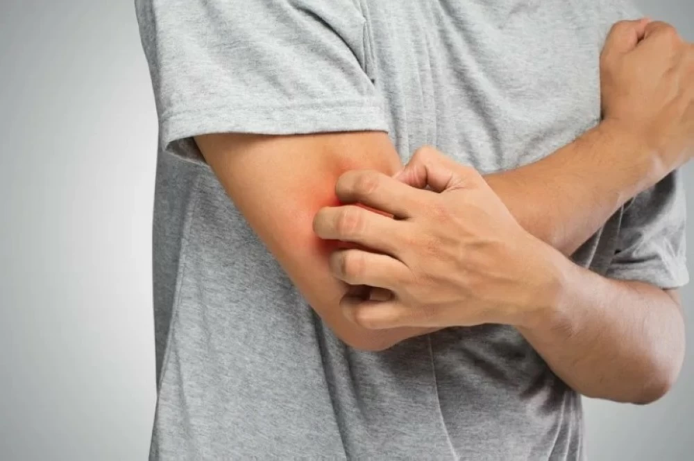 «الحكة المزمنة عند كبار السن ظاهرة تتطلب رعاية شاملة»  الحكة المزمنة تمثل تحدياً صحياً معقداً يتطلب استراتيجيات متكاملة لرعاية المسنين